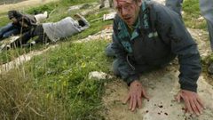 إصابة متضامنين أجنبيين بجروح في اعتداء للمستوطنين بمسافر يطا