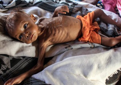 المجاعة تطال 5 ملايين شخص في السودان