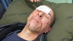قوات الاحتلال تعتدي بالضرب المبرح على ضابط فلسطيني