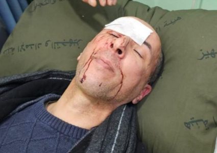 قوات الاحتلال تعتدي بالضرب المبرح على ضابط فلسطيني