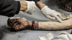 إصابات بقصف الاحتلال لمنطقة القرارة في قطاع غزة