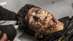 إصابات بقصف الاحتلال لمنطقة القرارة في قطاع غزة