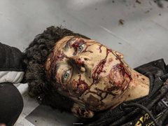 ‏من مستشفى شهداء الأقصى بعد وصول إصابات بقصف الاحتلال لمنطقة القرارة في قطاع غزة