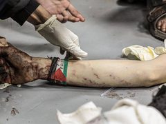 ‏من مستشفى شهداء الأقصى بعد وصول إصابات بقصف الاحتلال لمنطقة القرارة في قطاع غزة