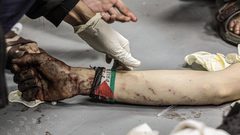 إصابات بقصف الاحتلال لمنطقة القرارة في قطاع غزة