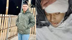 استشهاد شاب برصاص الاحتلال في مخيم طولكرم