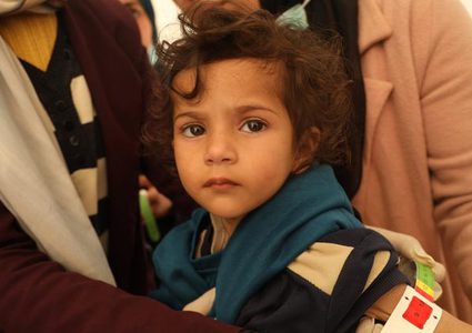 أطفال غزة بين الحياة والموت.. اليونيسف تحذر: سوء التغذية يتفاقم