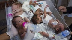 استشهاد 6 أطفال نتيجة الجفاف وسوء التغذية بمستشفى كمال عدوان شمال غزة