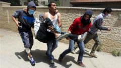 إصابة شاب برصاص الاحتلال خلال مواجهات على حاجز قلنديا