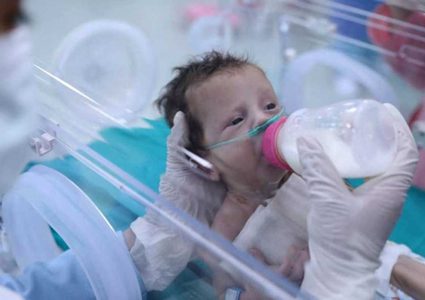 الأونروا: واحد من كل 3 أطفال دون العامين في غزة يعاني من سوء تغذية حاد