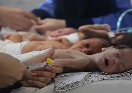 بسبب المجاعة: وفاة طفل بمستشفى كمال عدوان ما يرفع الحصيلة إلى 30