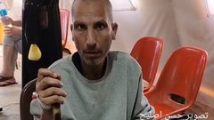 خرج للعالم بقدم واحدة .. سفيان أبو صلاح أسير محرر فقد قدمه بين قضبان الإهمال