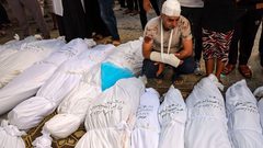في اليوم 225 للعدوان: جرحى في قصف الاحتلال لمناطق عدة من قطاع غزة تركزت في رفح