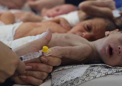 المكتب الإعلامي الحكومي بغزة: أكثر من 3500 طفل معرضون لخطر الموت بسبب نقص الغذاء