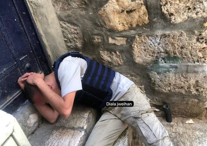 إصابة الصحفي سيف القواسمي نتيجة اعتداء المستوطنين عليه في القدس المحتلة.