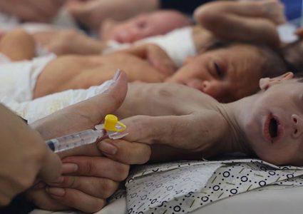 خطر الموت يواجه نحو 3000 طفل في غزة محرومون من علاج سوء التغذية