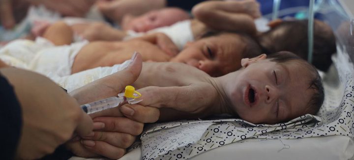 خطر الموت يواجه نحو 3000 طفل في غزة محرومون من علاج سوء التغذية