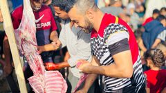 فلسطينيون يقومون بتعظيم شعائر الله في ذبح الأضاحي بما توفر بقطاع غزة رغم الحصار