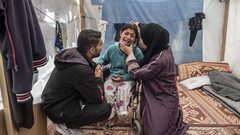 «أونروا»: 10 أطفال يفقدون ساقاً أو ساقين في غزة يومياً