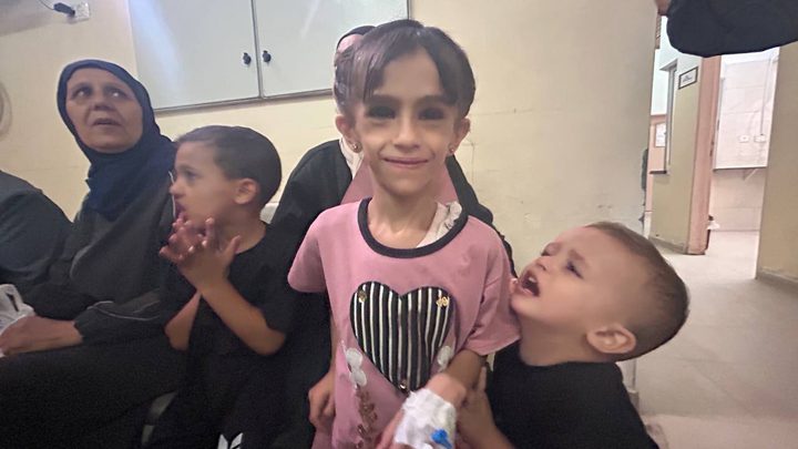 أول دفعة من أطفال غزة المصابين بالسرطان تغادرها للعلاج وآلاف المرضى ينتظرون