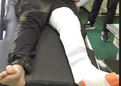 قوات الاحتلال تعتدي على مواطن بالضرب جنوب مدينة طولكرم