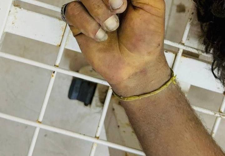 مكبلو الأيدي.. جثامين ثلاثة شهداء قتلهم الاحتلال بعد قصفهم لحظة الإفراج عنهم قرب معبر كرم أبو سالم جنوب القطاع.