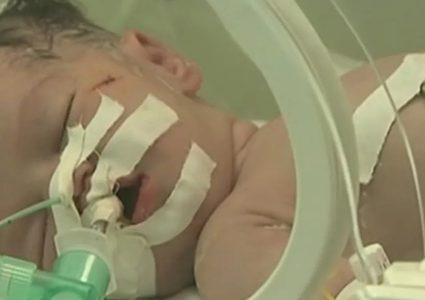 مستشفى العودة: إنقاذ جنين من رحم والدته الشهيدة