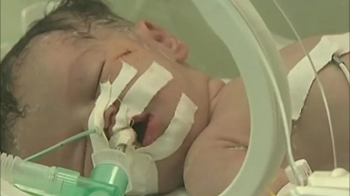 مستشفى العودة: إنقاذ جنين من رحم والدته الشهيدة