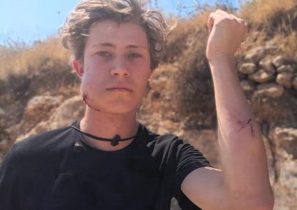 إصابة مواطن ومتضامنين أميركيين إثر اعتداء مستوطنين في قصرة جنوب نابلس