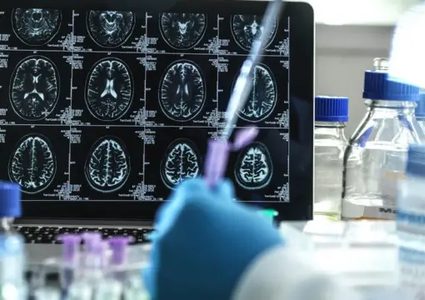 وكالة الأدوية الأوروبية ترفض طرح دواء يبطئ تطور الزهايمر