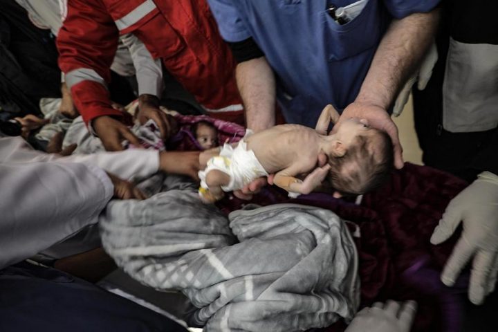 اليونيسيف تدعو الى هدنة ٧ ايام لتلقيح ٦٧٠ الف طفل ضد شلل الأطفال