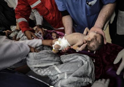 اليونيسيف تدعو الى هدنة ٧ ايام لتلقيح ٦٧٠ الف طفل ضد شلل الأطفال