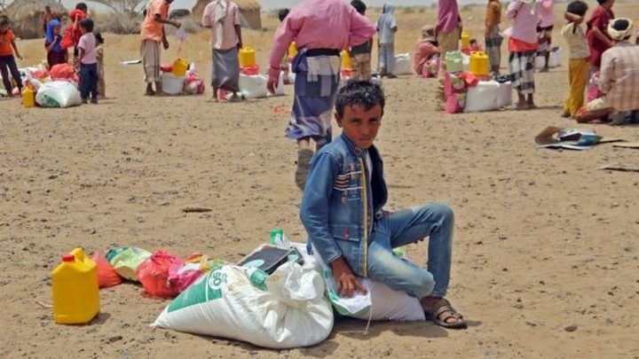 ارتفاع سوء التغذية لأطفال اليمن بنسبة ٣٤٪؜