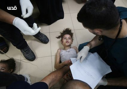 نقل إصابات بينهم أطفال إلى مستشفى شهداء الأقصى بدير البلح وسط قطاع غزة.