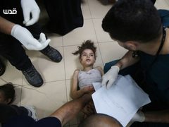 نقل إصابات بينهم أطفال إلى مستشفى شهداء الأقصى بدير البلح وسط قطاع غزة.