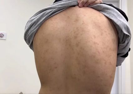 هيئة الأسرى: مرض السكابيوس يهدد حياة المعتقلين الأشبال في سجن عوفر