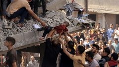 ندوب الحرب: عام من الإبادة تركت آثارا نفسية عميقة وجراحا لا تلتئم