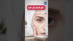 ح 5 صحتك في دقيقة - السكر وأضراره لجسم الإنسان