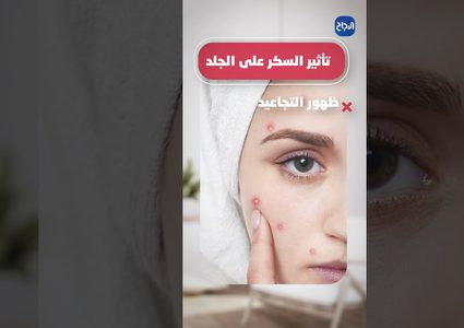 ح 5 صحتك في دقيقة - السكر وأضراره لجسم الإنسان