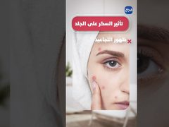 ح 5 صحتك في دقيقة - السكر وأضراره لجسم الإنسان