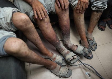 تحقيق: الجرب ينتشر بين ربع الأسرى الفلسطينيين مؤخرًا