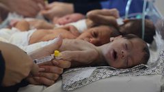 أونروا تحذّر من معاناة الأطفال في غزة بسبب سوء التغذية الحاد