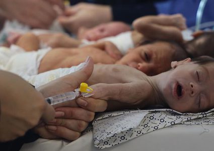 أونروا تحذّر من معاناة الأطفال في غزة بسبب سوء التغذية الحاد