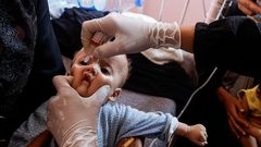 تسجيل حالتين تعانيان من أعراض شلل الأطفال في غزة