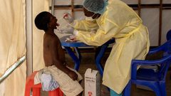 الصين ترصد سلالة فرعية متحورة جديدة من جدري القردة