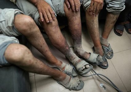 تفاصيل صادمة: جرائم تعذيب وتنكيل وتجويع وجرائم طبية بحق معتقلي غزة