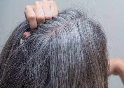 علميا.. مضادات الأكسدة ربما تؤخر ظهور الشعر الأبيض