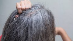 علميا.. مضادات الأكسدة ربما تؤخر ظهور الشعر الأبيض