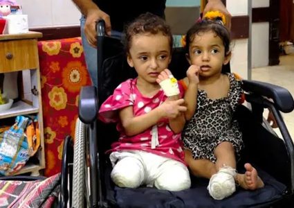 مكتب أممي: في غزة أكبر مجموعة من الأطفال مبتوري الأطراف بالتاريخ الحديث