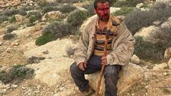 إصابات إثر اعتداء المستوطنين على رعاة ومواطنين في مسافر يطا